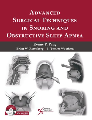 Advanced Surgical Techniques In Snoring And Obstructive Sleep Apnea Illustrated Kenny Peter Pang Editor