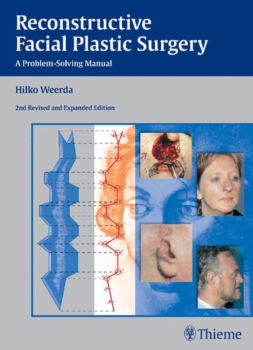 Reconstructive Facial Plastic Surgery 2nd Edition Hilko Weerda