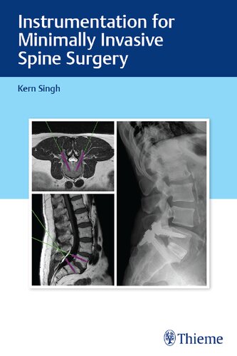 Instrumentation For Minimally Invasive Spine Surgery 1st Edition Singh