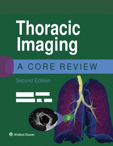 Thoracic Imaging A Core Review 2nd Edition Stephen B Hobbs