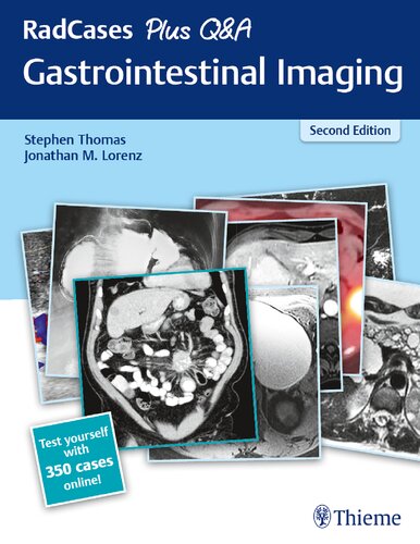 Radcases Plus Qa Gastrointestinal Imaging 2nd Edition Stephen Thomas Jonathan M Lorenz