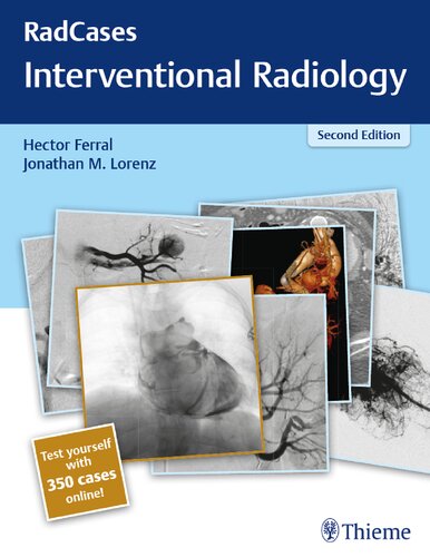 Radcases Interventional Radiology 2nd Edition Hector Ferral Jonathan M Lorenz