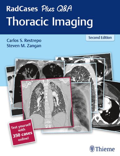 Radcases Plus Qa Thoracic Imaging 2nd Edition Carlos S Restrepo Steven M Zangan
