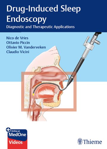 Druginduced Sleep Endoscopy Diagnostic And Therapeutic Applications Nico De Vries