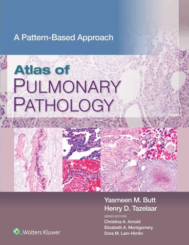 Atlas Of Pulmonary Pathology A Pattern Based Approach Yasmeen Mahmood Butt