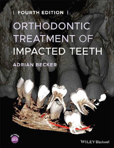 Orthodontic Treatment Of Impacted Teeth 4th Edition Adrian Becker