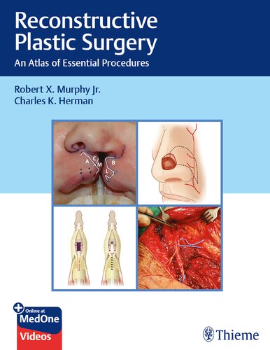 Reconstructive Plastic Surgery An Atlas Of Essential Procedures Robert Murphy
