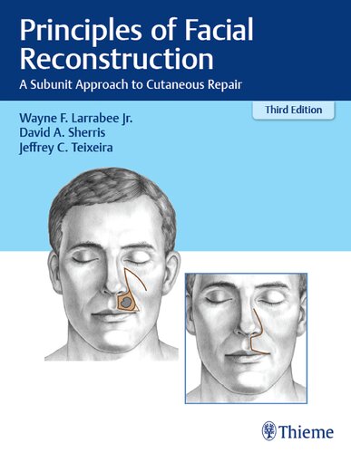 Principles Of Facial Reconstruction A Subunit Approach To Cutaneous Repair 3rd Edition Wayne F Larrabee