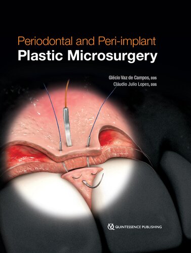 Periodontal And Periimplant Plastic Microsurgery Minimally Invasive Techniques With Maximum Precision Glcio Vaz De Campos