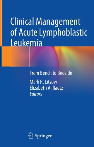 Clinical Management Of Acute Lymphoblastic Leukemia From Bench To Bedside Mark R Litzow