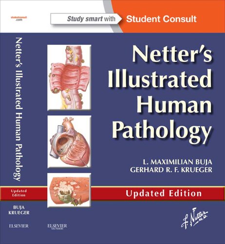 Netters Illustrated Human Pathology Updated L Maximilian Buja Gerhard R F Krueger