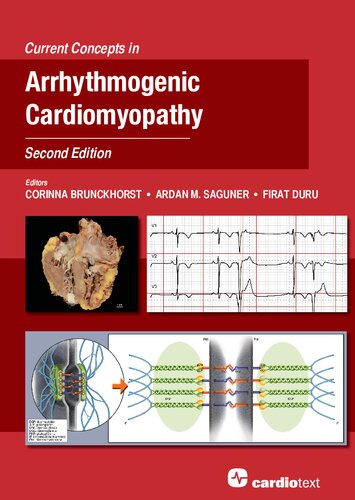Current Concepts In Arrhythmogenic Cardiomyopathy Second Edition 2nd Edition Corinna Brunckhorst Ardan M Saguner Firat Duru
