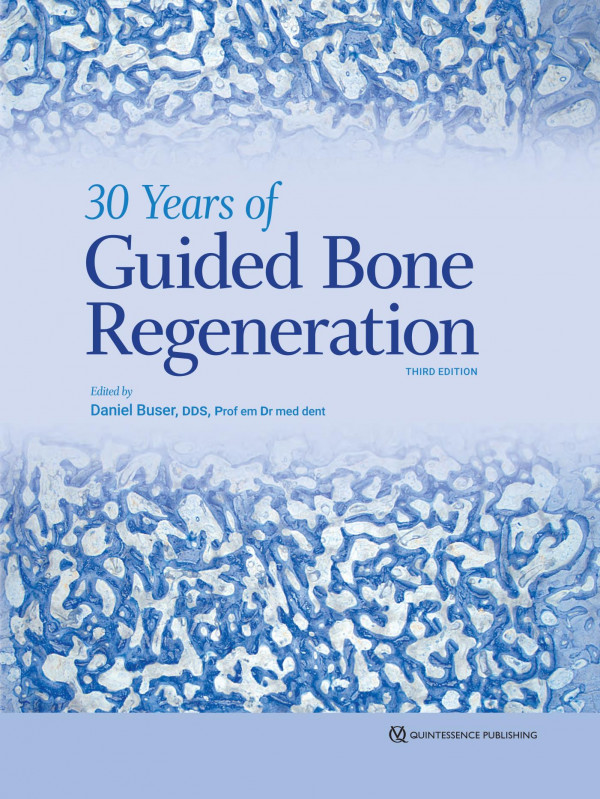 30 Years Of Guided Bone Regeneration In Implant Dentistry 3rd Edition Daniel Buser