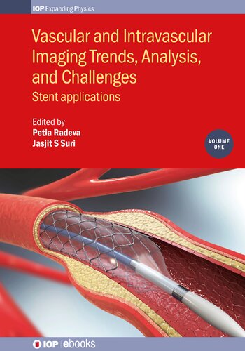 Vascular And Intravascular Imaging Trends Analysis And Challenges Volume 1 Stent Applications Petia Radeva