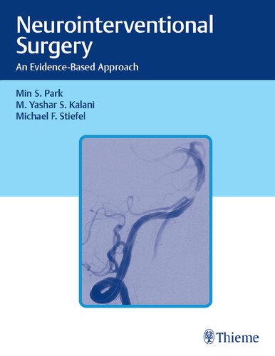 Neurointerventional Surgery An Evidencebased Approach Min S Park