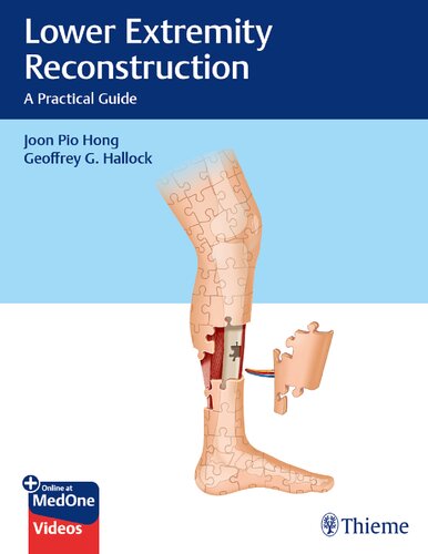 Lower Extremity Reconstruction A Practical Guide Joon Pio Hong