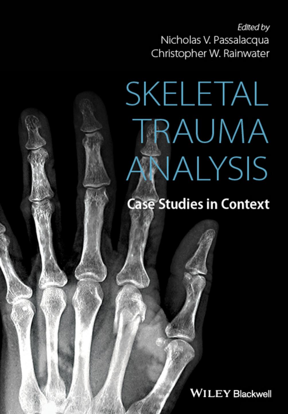 Skeletal Trauma Analysis Case Studies In Context 1st Edition Nicholas V Passalacqua