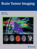 Brain Tumor Imaging Rajan Jain Marco Essig