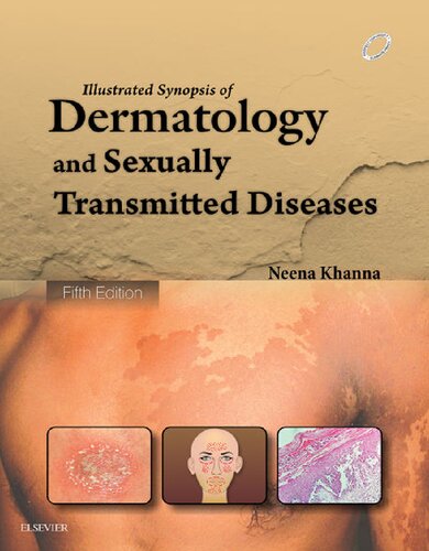 Illustrated Synopsis Of Dermatology And Sexually Transmitted Diseases 5th Edition Neena Khanna