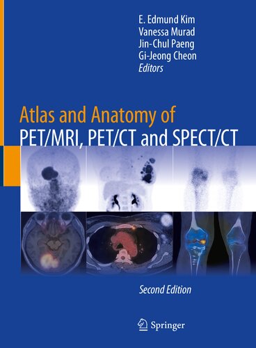 Atlas And Anatomy Of Petmri Petct And Spectct 2nd Edition 2nd Edition E Edmund Kim