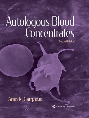 Autulogous Blood Concentrates 2nd Edition Arun K Garg