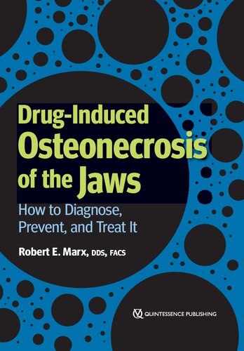 Druginduced Osteonecrosis Of The Jaws How To Diagnose Prevent And Treat It Robert E Marx