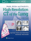 Webb Mller And Naidichs Highresolution Ct Of The Lung Sixth Desai