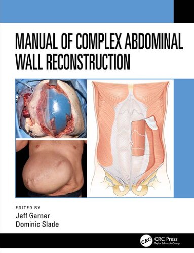 Manual Of Complex Abdominal Wall Reconstruction 1st Edition Jeff Garner