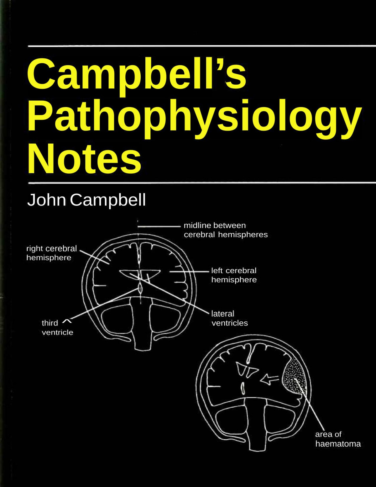 Campbells Pathophysiology Notes Campbells Notes John Campbell