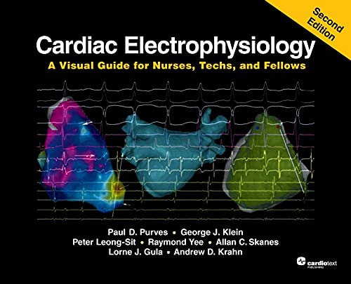 Cardiac Electrophysiology A Visual Guide For Nurses Techs And Fellows 2nd Edition 2nd Edition Purves