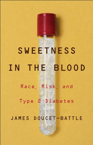 Sweetness In The Blood Race Risk And Type 2 Diabetes 1st Edition James Doucetbattle