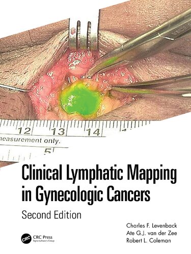 Clinical Lymphatic Mapping In Gynecologic Cancers 2nd Edition Charles F Levenback