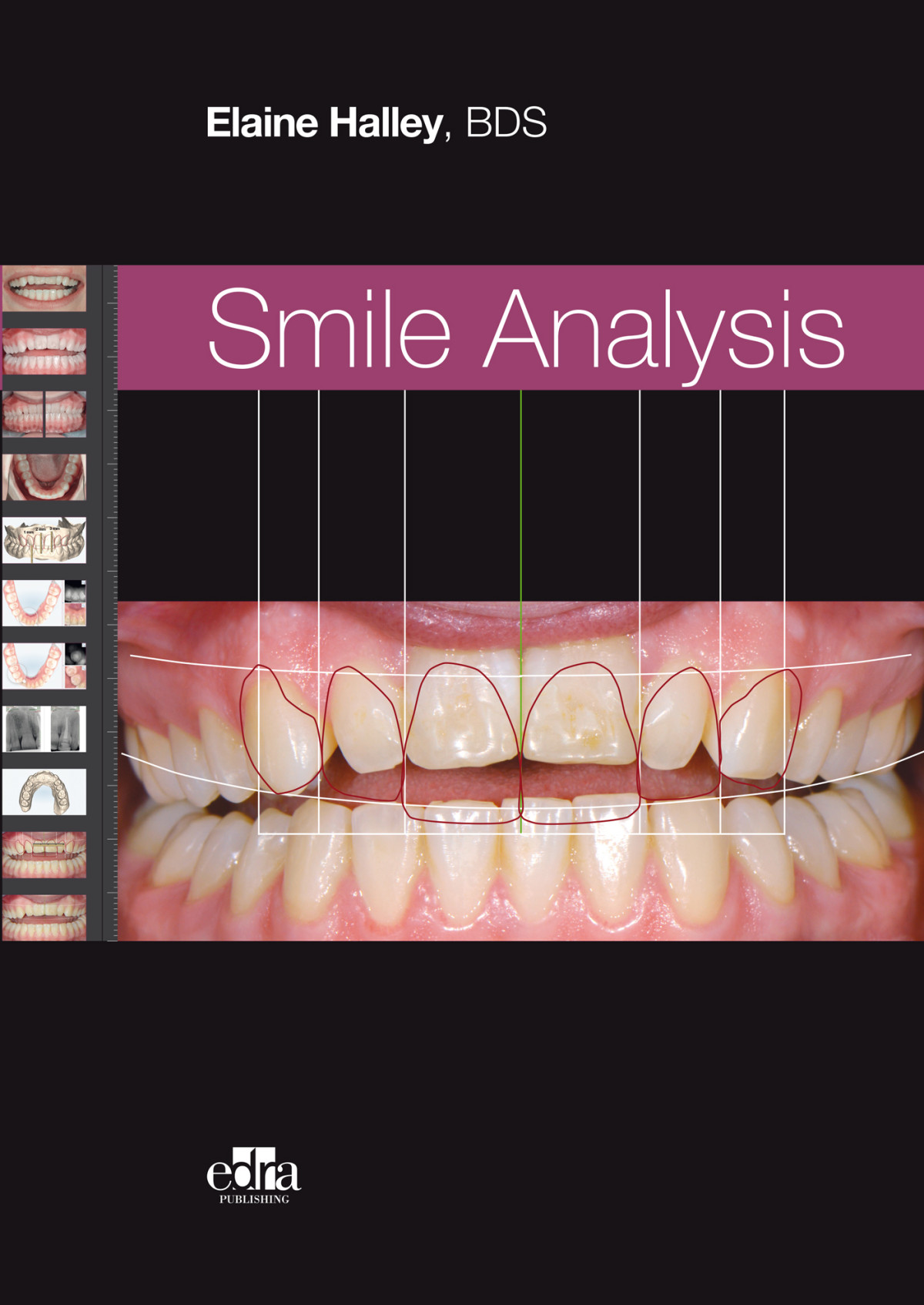 Smile Analysis Elaine Halley Bds