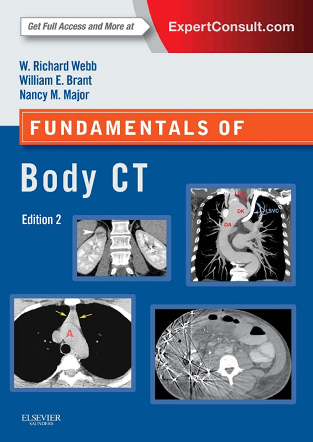 Fundamentals Of Body Ct W Richard Webb