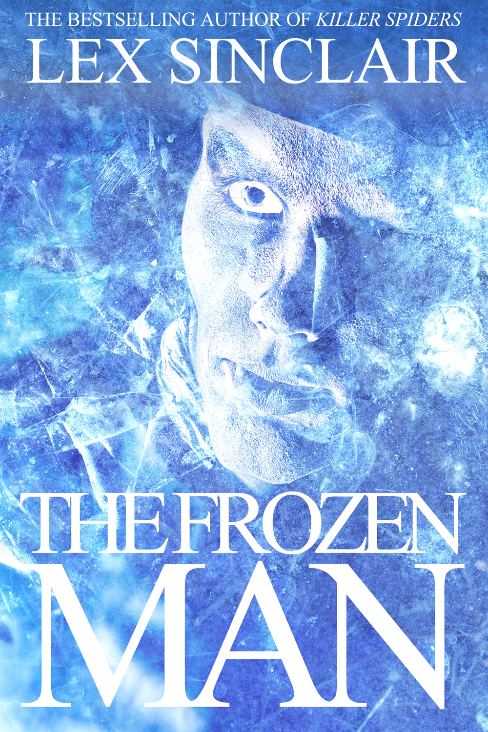 The Frozen Man Sinclair Lex