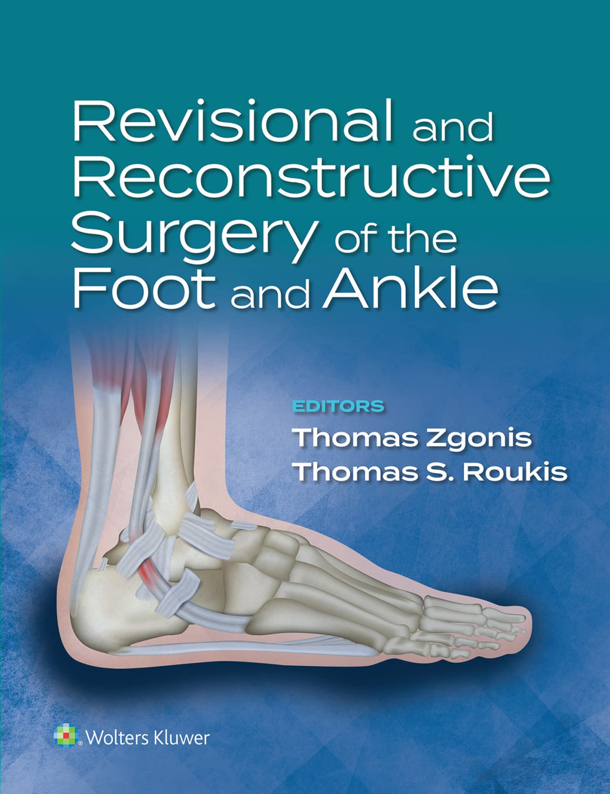 Revisional And Reconstructive Surgery Of The Foot And Ankle Thomas Zgonis