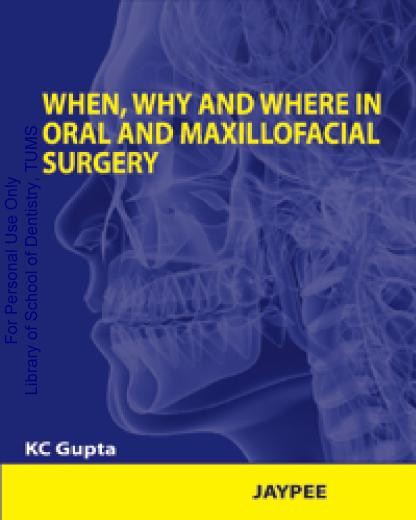 When Why And Where In Oral And Maxillofacial Surgery Prep Manual For Undergraduates And Postgraduates 1st Edition Gupta