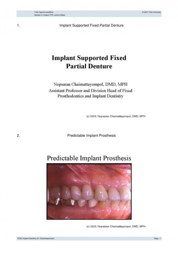 Implant Supported Fixed Partial Dentures A Comparative Fem Study Of Deflection Seen In Fixed Partial Dentures Supported By Implants Teeth And Their Combination Shariff