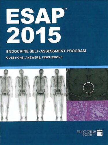 Esap 2015 Endocrine Selfassessment Program Questionsanswers Discussions Endocrine Society Endocrine Society