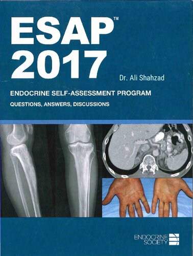 Esap 2017 Endocrine Selfassessment Program Questionsanswers Discussions Endocrine Society Dr Ali Shahzad
