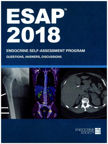 Esap 2018 Endocrine Selfassessment Program Questions Answers Discussions Endocrine Society