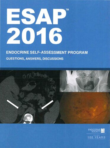Esap 2016 Endocrine Selfassessment Program Questionsanswers Discussions Endocrine Society Alan C Dalkin