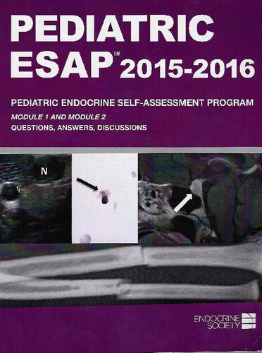 Pediatric Esap 20152016 Endocrine Self Assessment Program Module 1 2 Questionsanswersdiscussions Endocrine Society