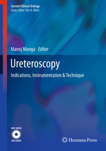 Ureteroscopy Indications Instrumentation Technique Manoj Monga