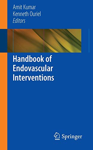 Handbook Of Endovascular Interventions Amit Kumar