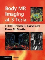 Body Mr Imaging At 3 Tesla 1st Edition Ihab R Kamel Elmar M Merkle