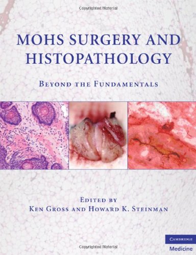 Histopathology On Mohs Surgery 1st Edition Kenneth G Gross Howard K Steinman