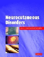 Neurocutaneous Disorders 1st Edition E S Roach Van S Miller