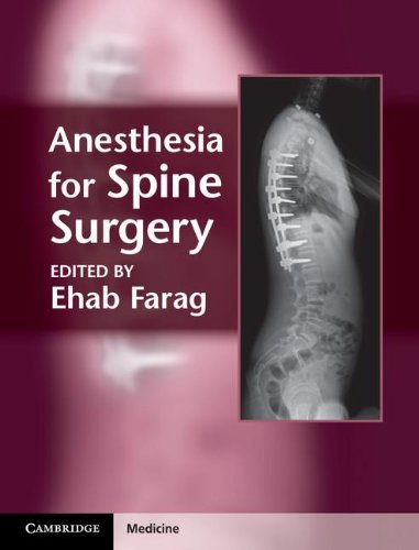 Anesthesia For Spine Surgery 1st Edition Ehab Farag