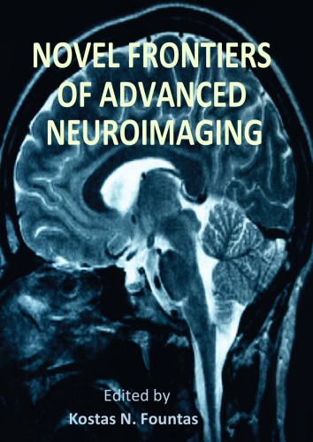 Novel Frontiers Of Advanced Neuroimaging Kostas N Fountas